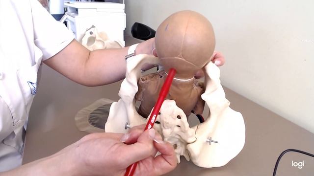 Биомеханизм родов при переднеголовном предлежании смотреть онлайн