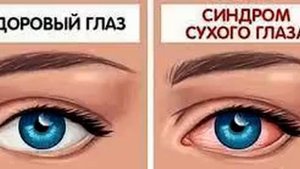 Психосоматика плохого зрения: Синдром "сухого глаза"