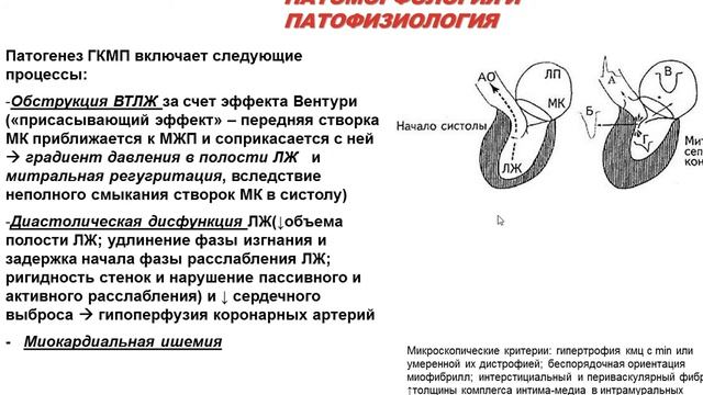 Кардиомиопатии