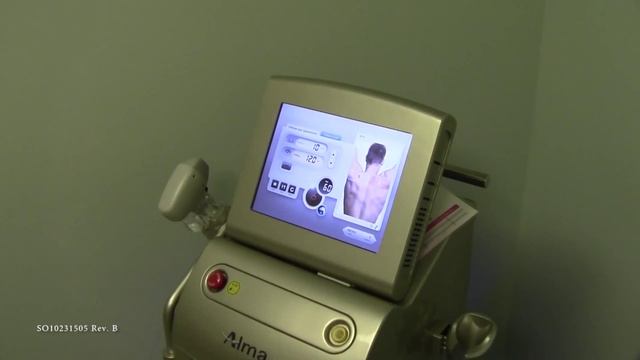 Soprano ICE - Male Pateint Testimonial смотреть онлайн