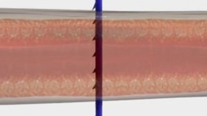 Инновация! Нить с насечками и концевым блоком