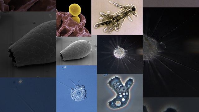 Amoebae | Wikipedia audio article смотреть онлайн