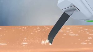 УЗИ чистка    инновация для кожи