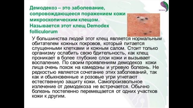 Омоложение лица, кожи и волос. Убрать морщины на лице, разглаживание морщин. Лечение демодекоза