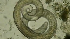 А так выглядит Trichinella_spiralis