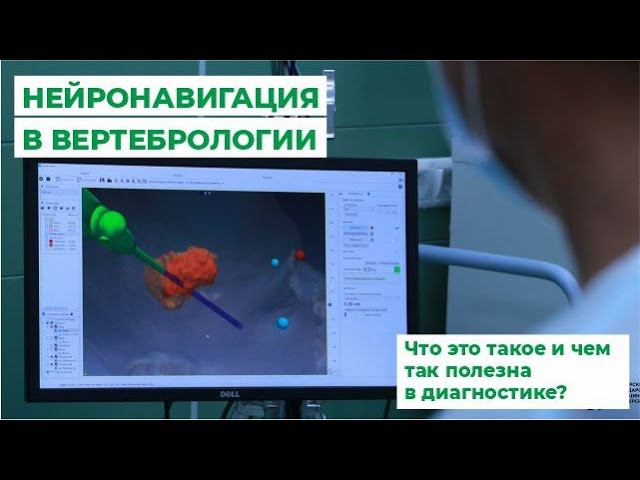 Нейронавигация в вертебрологии. Что это такое и чем так полезна в диагностике?