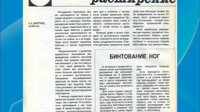 Лечение варикоза. Варикоз на ногах. Как избавиться от варикоза. Варикозное расширение вен лечение