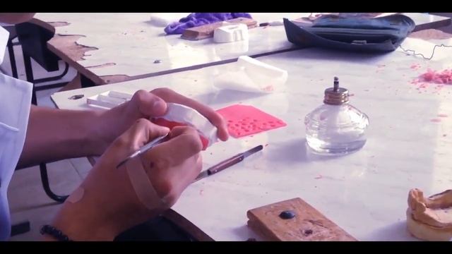 Лабораторные этапы изготовления частично съемного протеза. ЧАСТЬ 2