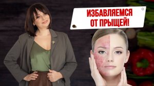 Как победить акне прыщи у подростка. Советы детского диетолога\нутрициолога.