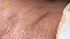 Satisfying and Relax Video with Hien Spa Beauty #01