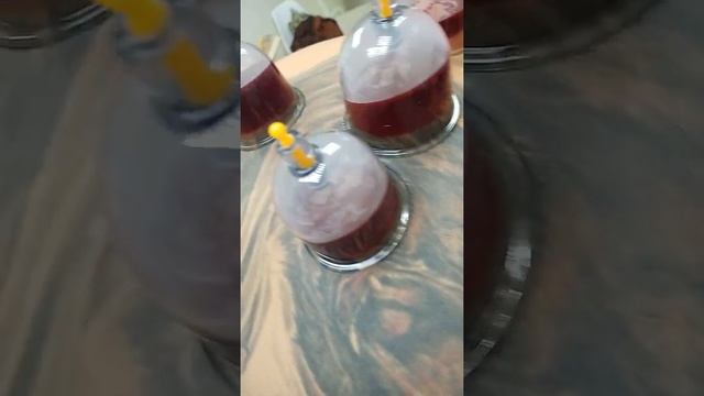 Хиджама массаж(3) смотреть онлайн