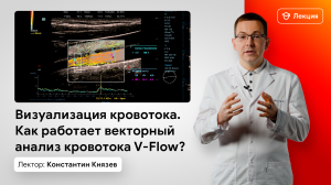 Визуализация кровотока. Как работает векторный анализ кровотока V-Flow