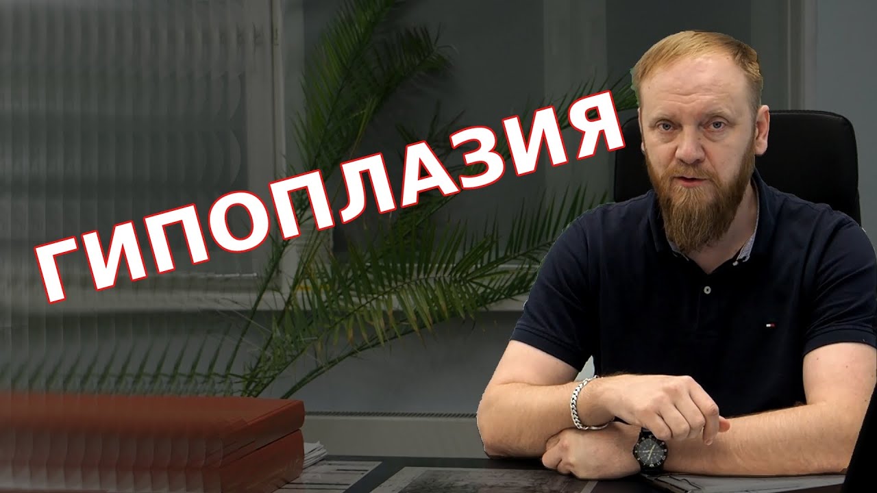 Гипоплазия левой позвоночной артерии (тахикардия, головокружение, падение зрения)