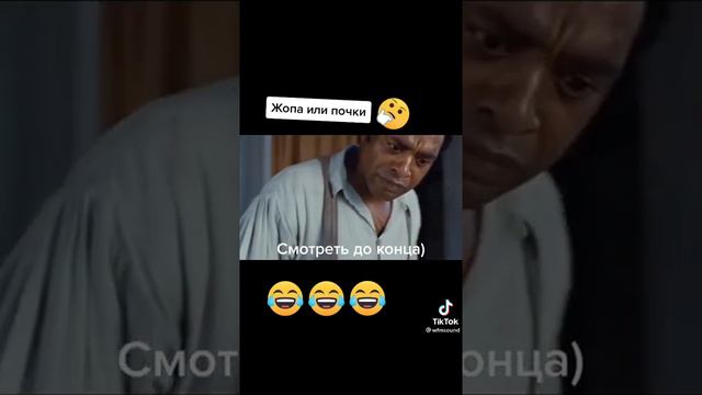 Что продашь жопу или почки