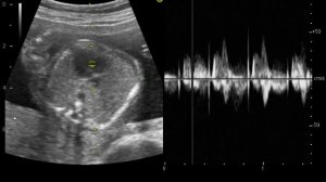4D узи моего ребенка