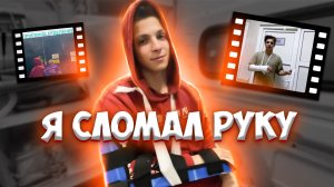Я СЛОМАЛ РУКУ
