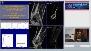 Н.В. Кочергина - Опухоли костно-мышечной системы: алгоритм лучевого исследования
