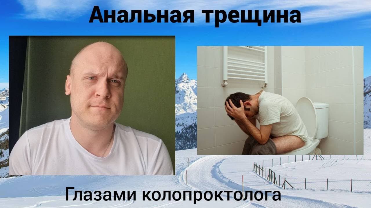 Анальная трещина. Глазами колопроктолога.