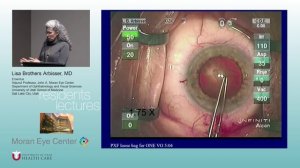 Mastering the Posterior Capsule: A Paradigm Change