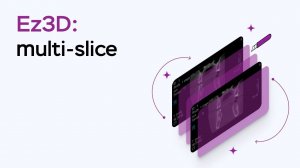 Возможности программы Ez3D: Multi-Slice