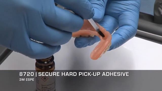 Перебазировка съемного протеза на мини имплантах 3M MDI смотреть онлайн