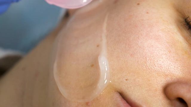 Hipro Q - компактное и быстро окупаемое решение для косметологического кабинета! смотреть онлайн