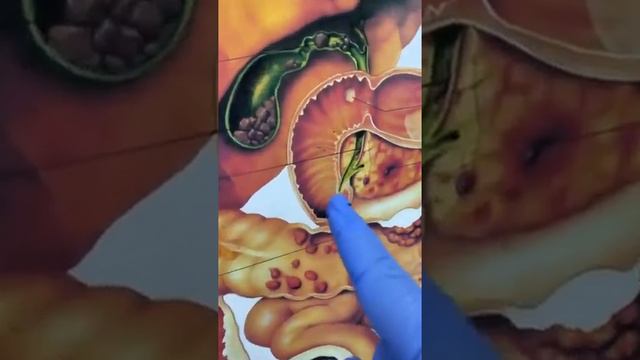 Что нужно делать что б не образовались камни в жёлчном пузыре. смотреть онлайн