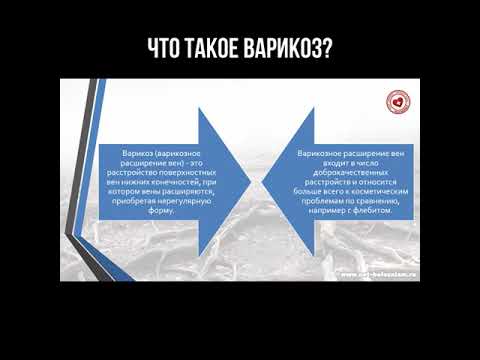 Что такое варикоз?