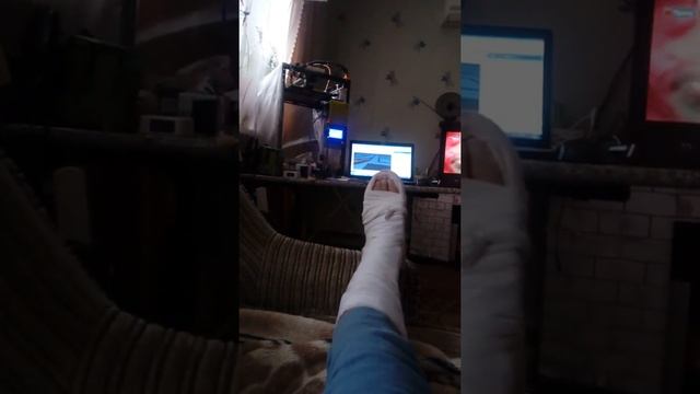 Перелом лодыжки продолжение. И немного о медицине.