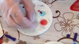 Группа крови. Как узнать группу крови и резус фактор?