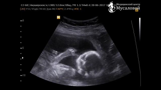 Чем занимается малыш в животе у мамы? смотреть онлайн