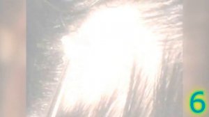 Паразиты в теле человека ужасный червь