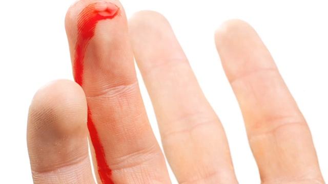 6 Признаков что ваш Печень умирает /Вы об этом должны знать! смотреть онлайн