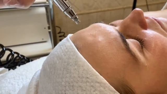 NANOASIA - Новейшая безынъекционная методика омоложения смотреть онлайн