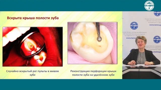 16 мая 2022 года - состоится мастер-класс «Травмы зуба» смотреть онлайн