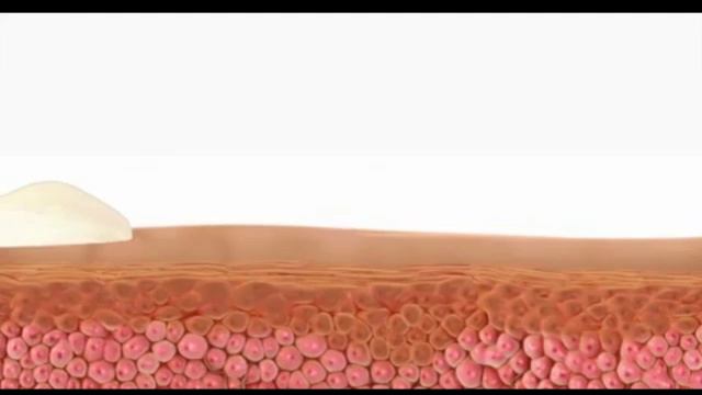 CURETOL Video смотреть онлайн