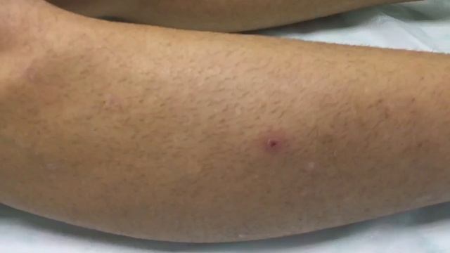 Шугаринг ноги полностью смотреть онлайн