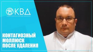 1198 Контагиозный моллюск после удаления
