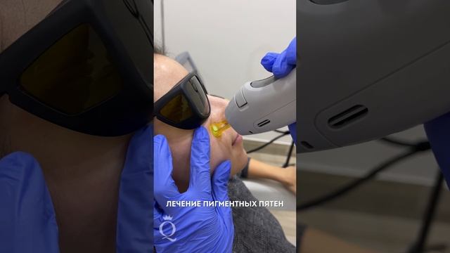 Лечение пигментных пятен