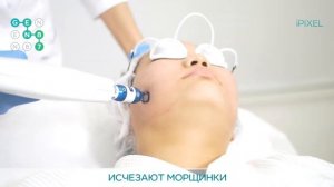 ФРАКЦИОННАЯ АБЛЯТИВНАЯ ШЛИФОВКА ЛИЦА iPixel (АйПиксель) Сеть клиник косметологии GEN87(2)
