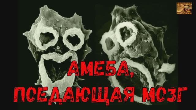 Смертоносная амеба, пожирающая мозг