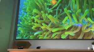 LG HU915QE 4K UHD Laser TV