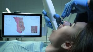 Стоматолог делает 3D скан челюсти пациента с помощью внутриорального сканера