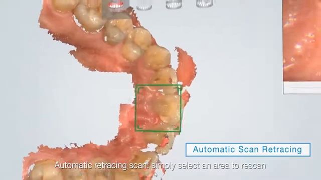 Aoralscan - интраоральный сканер | Shining 3D (Китай)