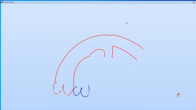 Открытый артериальный проток. Часть 1. смотреть онлайн