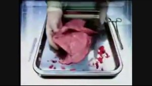 Вред от курения, курение вредит здоровью, последствия курения, пассивное курение