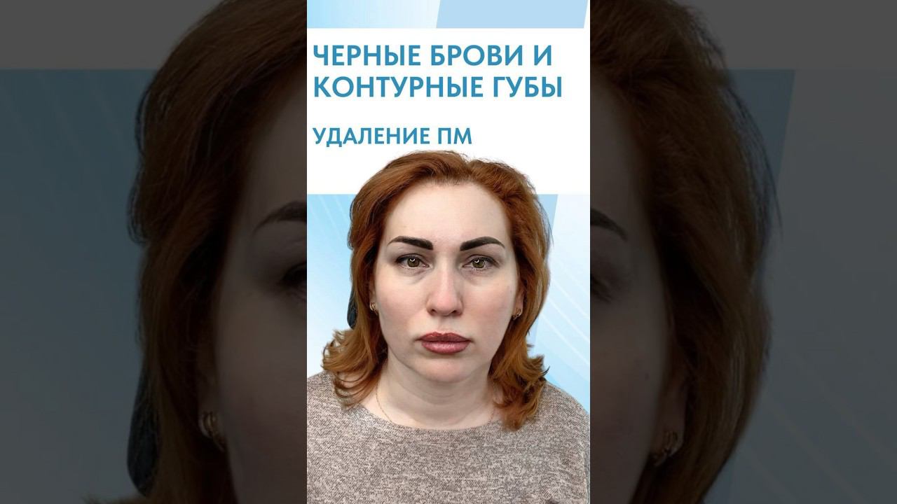 ЧЕРНЫЕ БРОВИ И КОНТУРНЫЕ ГУБЫ | УДАЛЕНИЕ ПМ