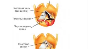 Голосообразование
