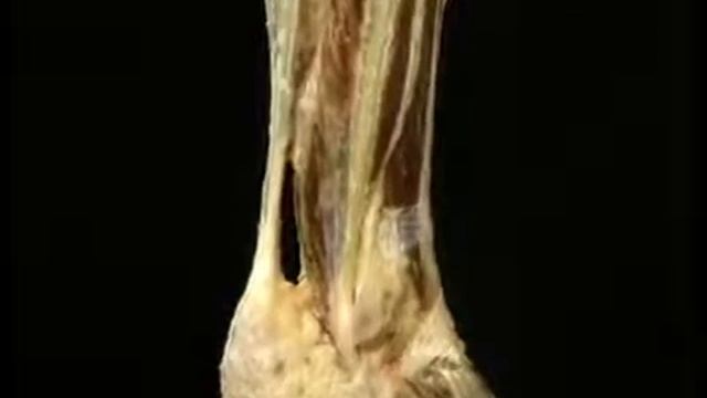 6 Голень и лодыжка смотреть онлайн