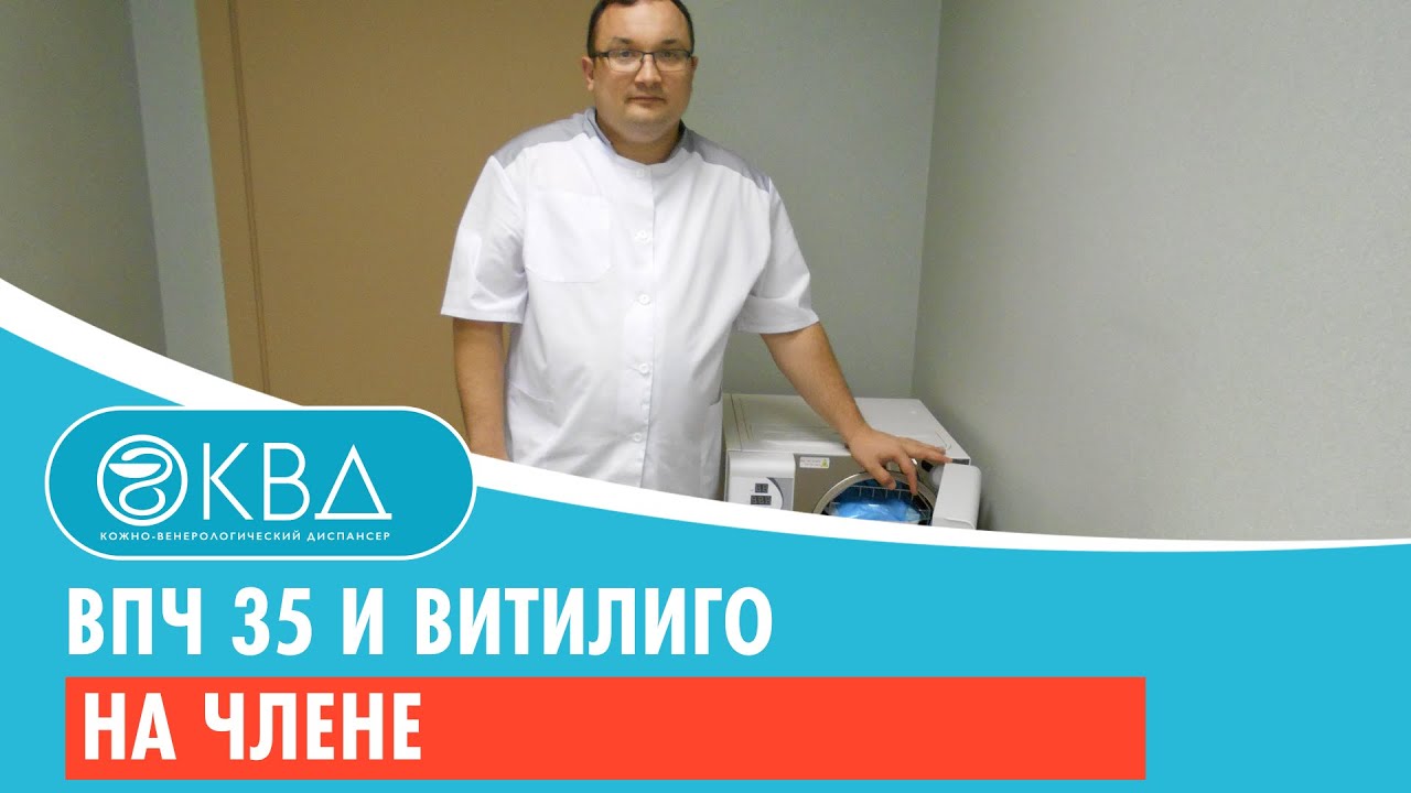 ? ВПЧ 35 и витилиго на члене. Клинический случай №258